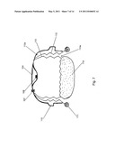 DEVICE FOR A TEMPORARY ILEOSTOMY OR UROSTOMY CLOSURE diagram and image