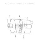 DEVICE FOR A TEMPORARY ILEOSTOMY OR UROSTOMY CLOSURE diagram and image