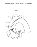 MEDICAL TUBE AND CATHETER USING THE SAME diagram and image