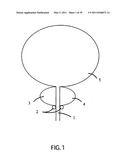 Low-Corrosion Electrode for Treating Tissue diagram and image