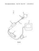 Low-Corrosion Electrode for Treating Tissue diagram and image