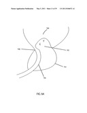 Low-Corrosion Electrode for Treating Tissue diagram and image