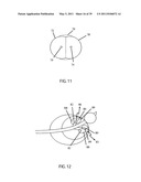 Low-Corrosion Electrode for Treating Tissue diagram and image