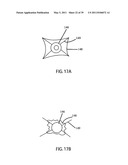 Low-Corrosion Electrode for Treating Tissue diagram and image