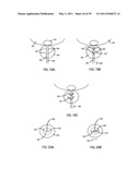 Low-Corrosion Electrode for Treating Tissue diagram and image