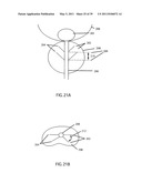 Low-Corrosion Electrode for Treating Tissue diagram and image