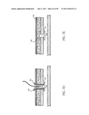 Methods and devices to treat obesity diagram and image