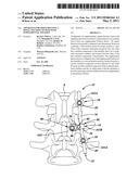 APPARATUS FOR IMPLEMENTING A SPINAL FIXATION SYSTEM WITH SUPPLEMENTAL FIXATION diagram and image