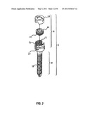 ADJUSTABLE SPINAL STABILIZATION SYSTEM diagram and image