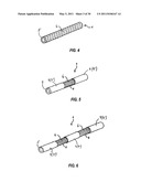 ADJUSTABLE SPINAL STABILIZATION SYSTEM diagram and image