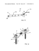 ADJUSTABLE SPINAL STABILIZATION SYSTEM diagram and image