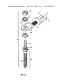 ADJUSTABLE SPINAL STABILIZATION SYSTEM diagram and image