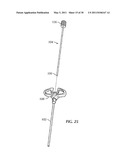 ADJUSTABLE SPINAL STABILIZATION SYSTEM diagram and image