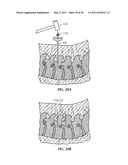 ADJUSTABLE SPINAL STABILIZATION SYSTEM diagram and image