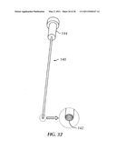 ADJUSTABLE SPINAL STABILIZATION SYSTEM diagram and image