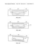 ADJUSTABLE SPINAL STABILIZATION SYSTEM diagram and image