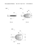 ANTERIOR INFLATION BALLOON diagram and image