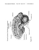 PATIENT CONTROLLED BRAIN REPAIR SYSTEM AND METHOD OF USE diagram and image