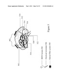 PATIENT CONTROLLED BRAIN REPAIR SYSTEM AND METHOD OF USE diagram and image