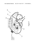 PATIENT CONTROLLED BRAIN REPAIR SYSTEM AND METHOD OF USE diagram and image