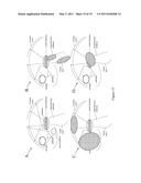 PATIENT CONTROLLED BRAIN REPAIR SYSTEM AND METHOD OF USE diagram and image