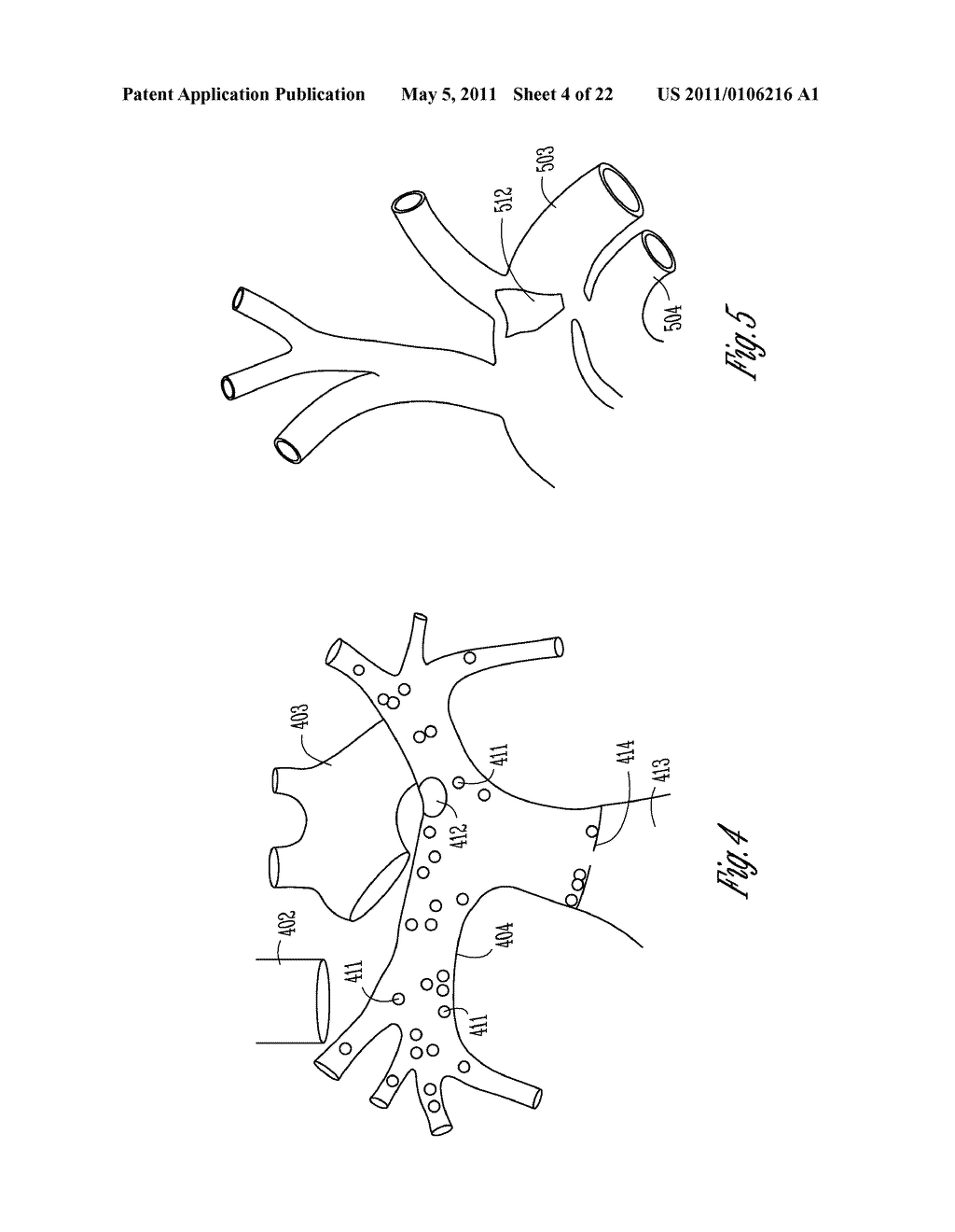 BAROREFLEX STIMULATOR WITH INTEGRATED PRESSURE SENSOR - diagram, schematic, and image 05