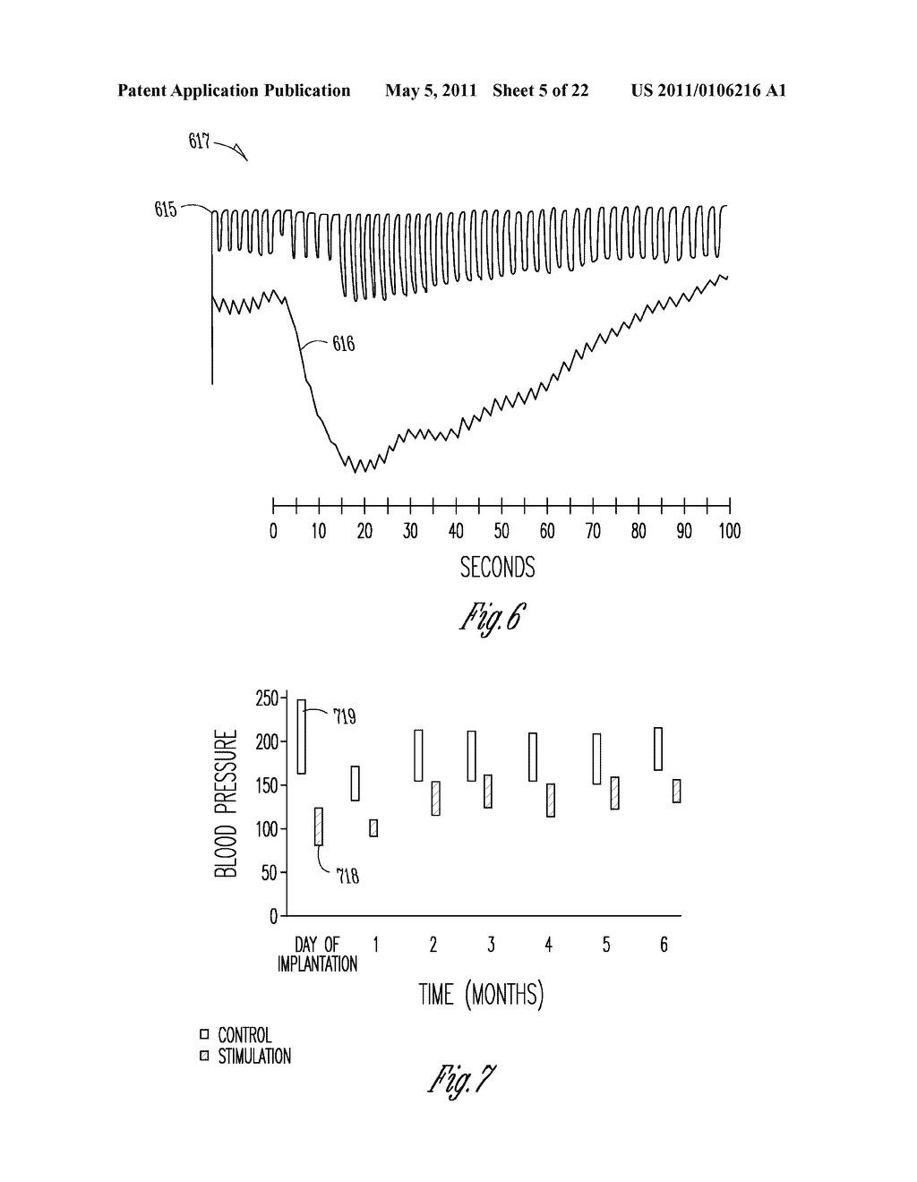 BAROREFLEX STIMULATOR WITH INTEGRATED PRESSURE SENSOR - diagram, schematic, and image 06