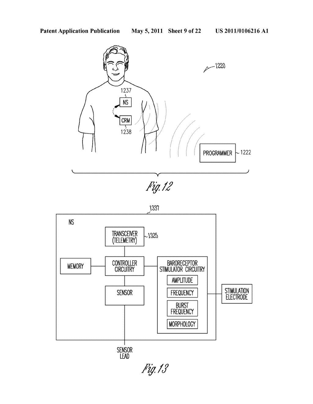 BAROREFLEX STIMULATOR WITH INTEGRATED PRESSURE SENSOR - diagram, schematic, and image 10