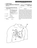 MRI-COMPATIBLE IMPLANTABLE LEAD HAVING A HEAT SPREADER AND METHOD OF USING SAME diagram and image