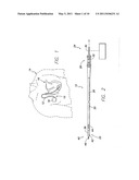 MRI-COMPATIBLE IMPLANTABLE LEAD HAVING A HEAT SPREADER AND METHOD OF USING SAME diagram and image