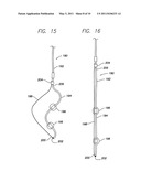 INTRAPERICARDIAL LEAD diagram and image