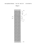 STENT AND STENT DELIVERY DEVICE diagram and image