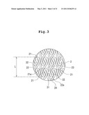 STENT AND STENT DELIVERY DEVICE diagram and image