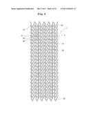 STENT AND STENT DELIVERY DEVICE diagram and image