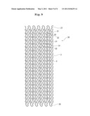 STENT AND STENT DELIVERY DEVICE diagram and image