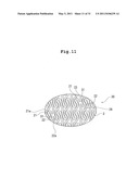 STENT AND STENT DELIVERY DEVICE diagram and image