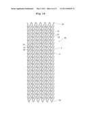 STENT AND STENT DELIVERY DEVICE diagram and image