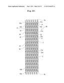 STENT AND STENT DELIVERY DEVICE diagram and image