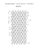 STENT AND STENT DELIVERY DEVICE diagram and image