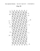 STENT AND STENT DELIVERY DEVICE diagram and image