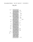 STENT AND STENT DELIVERY DEVICE diagram and image