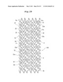 STENT AND STENT DELIVERY DEVICE diagram and image