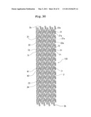 STENT AND STENT DELIVERY DEVICE diagram and image