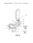 GASTROINTESTINAL PROSTHESES HAVING PARTIAL BYPASS CONFIGURATIONS diagram and image