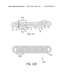 DEBARKING CHAIN WITH PASSING LINKS diagram and image