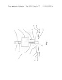 HAND-OPERATED HOISTING SYSTEM diagram and image