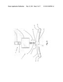 HAND-OPERATED HOISTING SYSTEM diagram and image