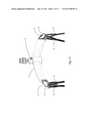 HAND-OPERATED HOISTING SYSTEM diagram and image