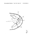 Preparation and Presentation of Patient-Individual Panoramic Visualizations diagram and image