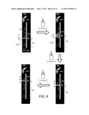 Displaying Computer-Aided Detection Information With Associated Breast Tomosynthesis Image Information diagram and image